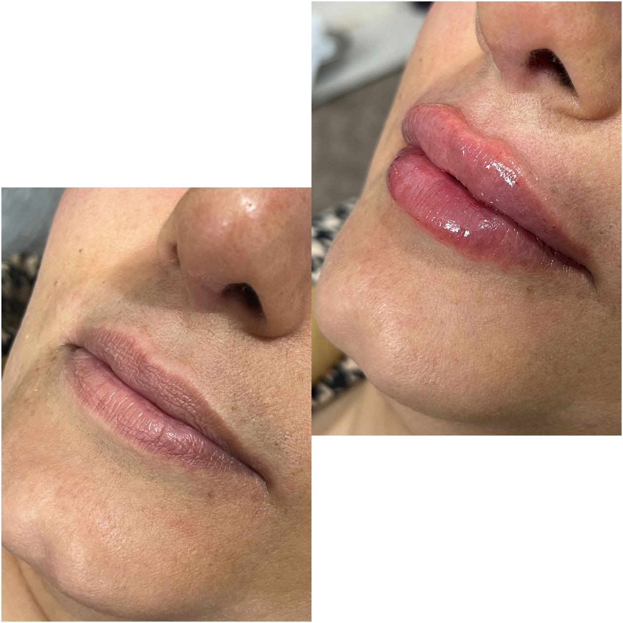 مطب زیبایی دکتر فاطمه موسوی در برازجان