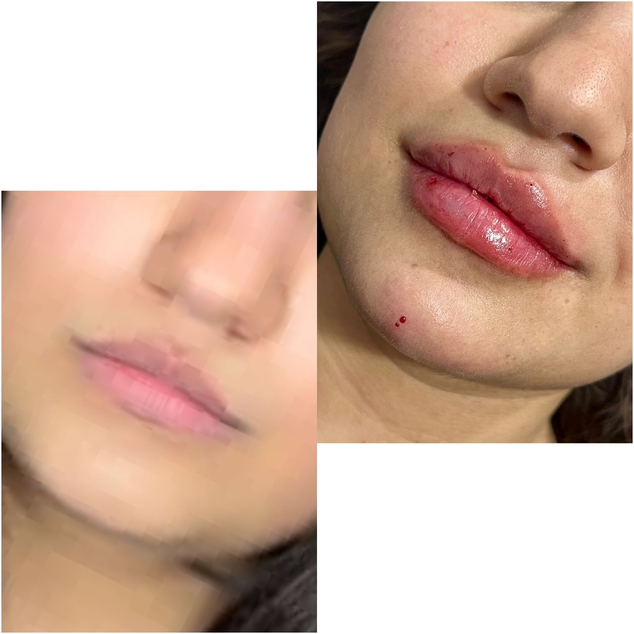 مطب زیبایی دکتر فاطمه موسوی در برازجان