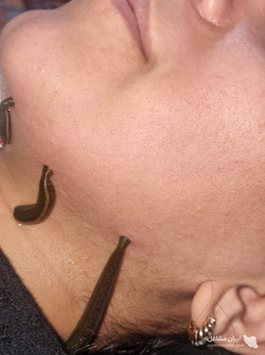 خدمات طب سنتی و ماساژ حرفه ای سلامت خانه صداقت در رباط کریم
