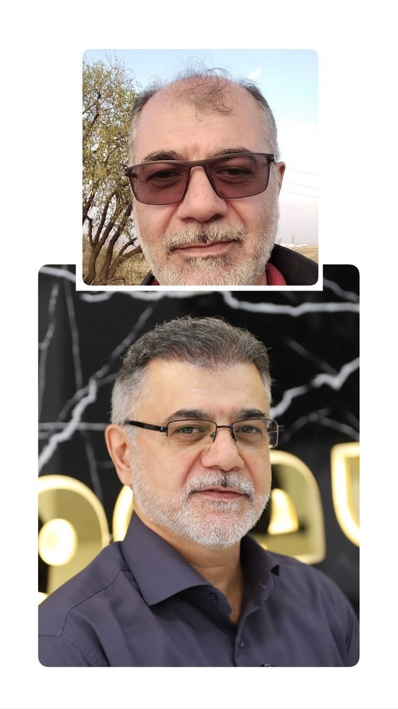 کلینیک کاشت مو و ابرو سقز کاشت در سقز