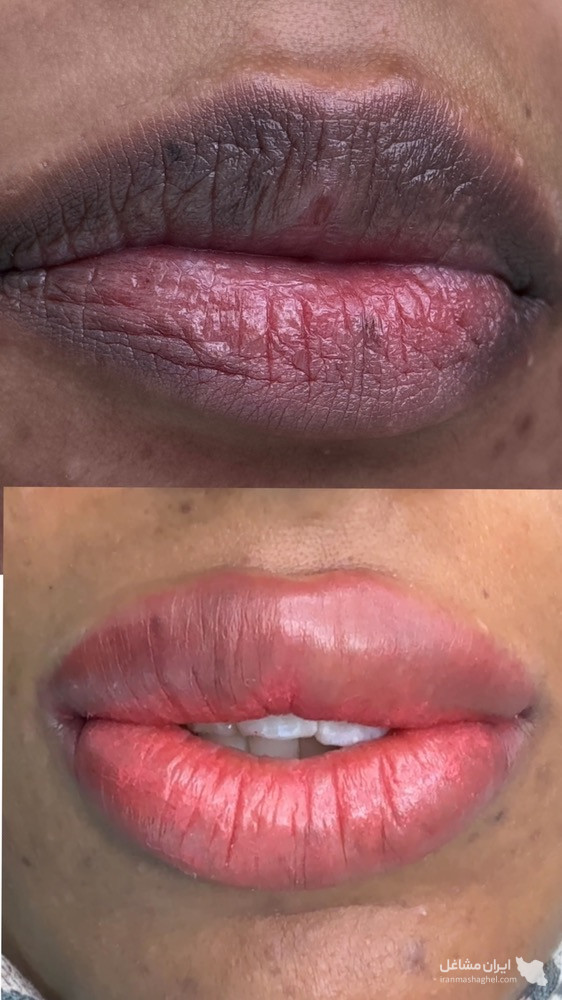 آموزش و خدمات تخصصی پاکسازی پوست و فشیال صورت هدیه تقویان در مشهد