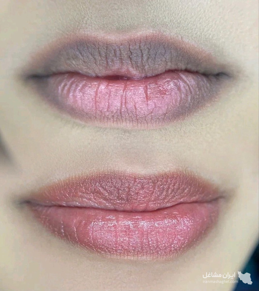 آموزش و خدمات تخصصی پاکسازی پوست و فشیال صورت هدیه تقویان در مشهد