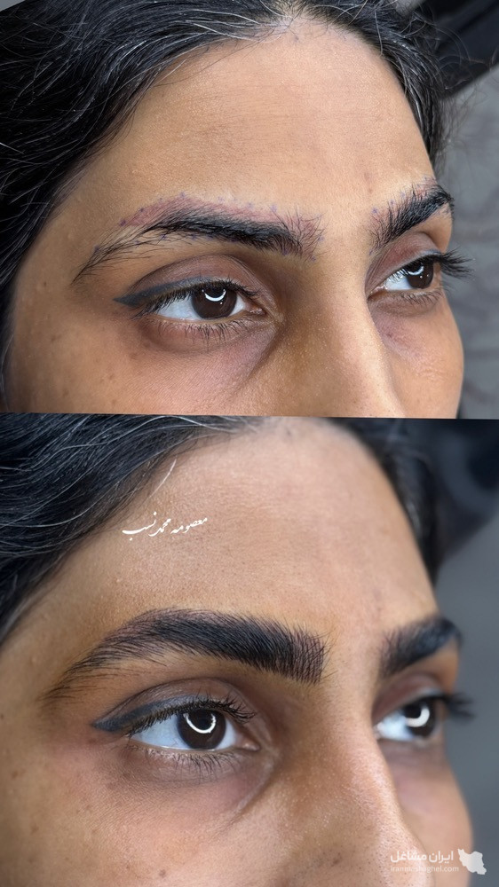 آموزش و خدمات تخصصی پاکسازی پوست و فشیال صورت هدیه تقویان در مشهد