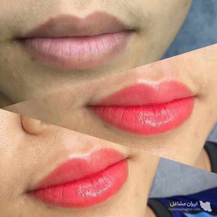 آموزش و خدمات تخصصی پاکسازی پوست و فشیال صورت هدیه تقویان در مشهد