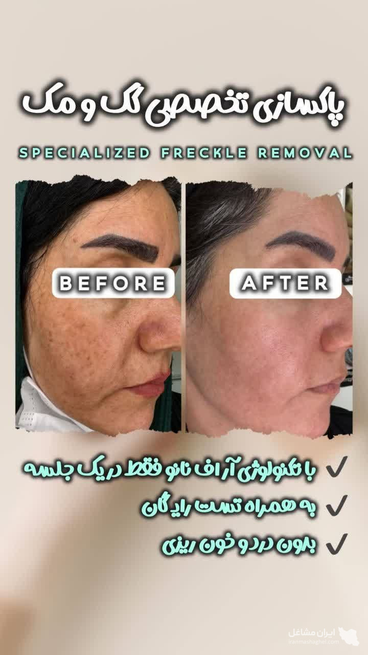 آموزش خدمات پاکسازی و فیشیال پوست پریسا رضائی در بروجرد