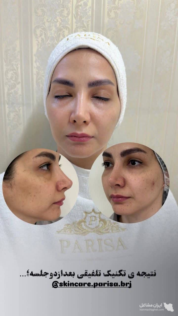 آموزش خدمات پاکسازی و فیشیال پوست پریسا رضائی در بروجرد