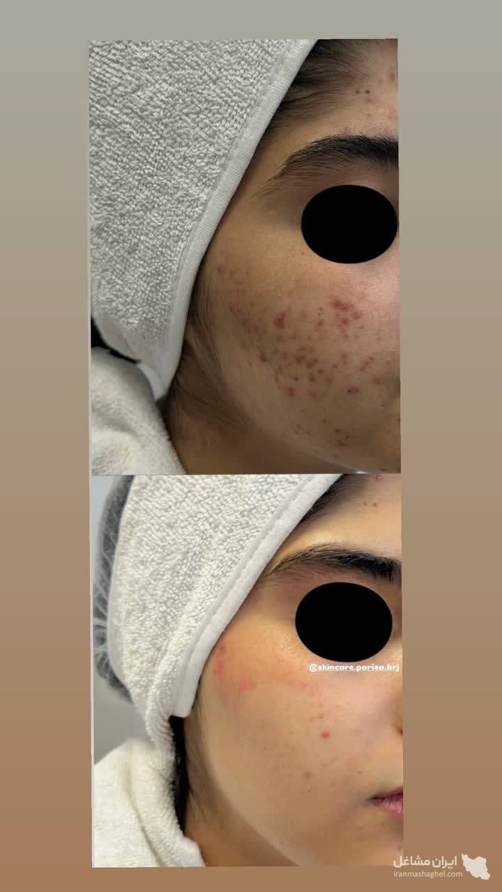 آموزش خدمات پاکسازی و فیشیال پوست پریسا رضائی در بروجرد