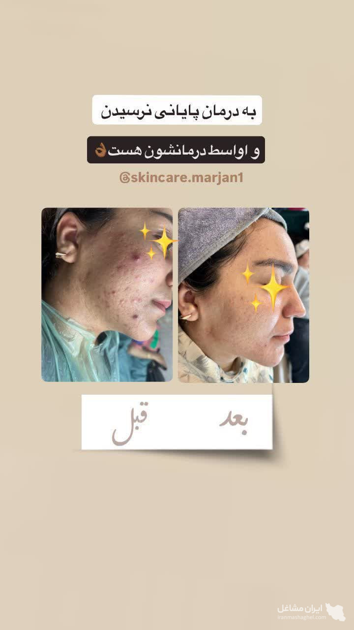 آموزش و خدمات تخصصی فشیال مرجان مظفری زاده در یزد