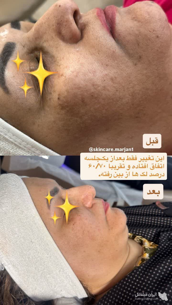 آموزش و خدمات تخصصی فشیال مرجان مظفری زاده در یزد