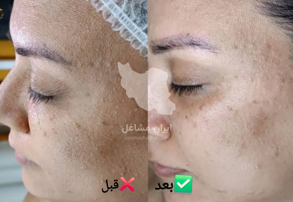 خدمات فیشیال و جوانسازی پوست به مدیریت خانم سحر پیکر در بهبهان