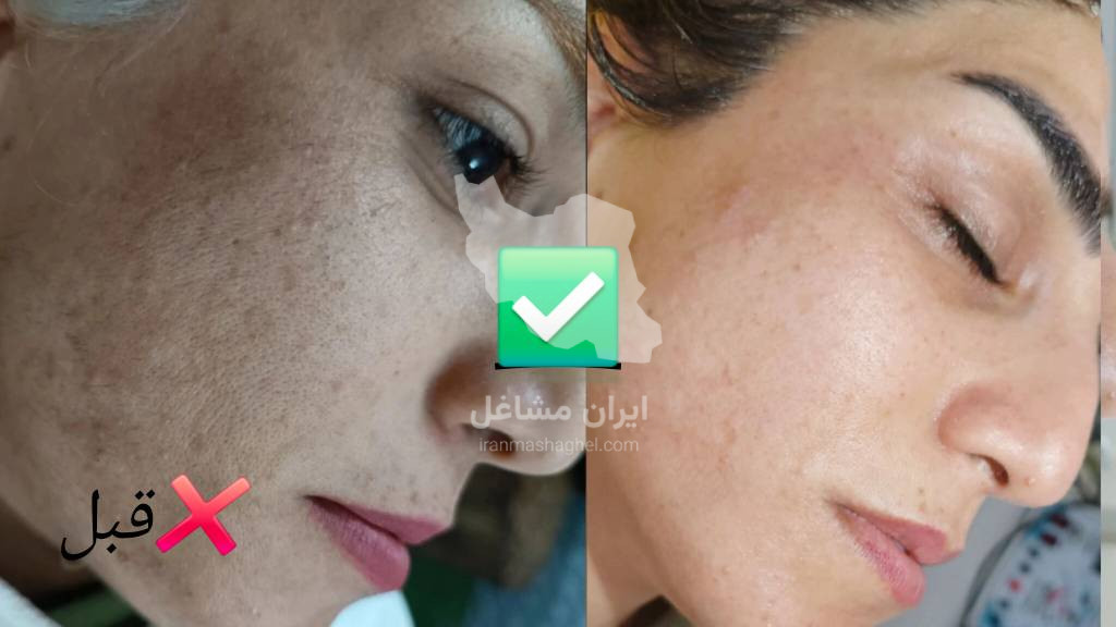 خدمات فیشیال و جوانسازی پوست به مدیریت خانم سحر پیکر در بهبهان