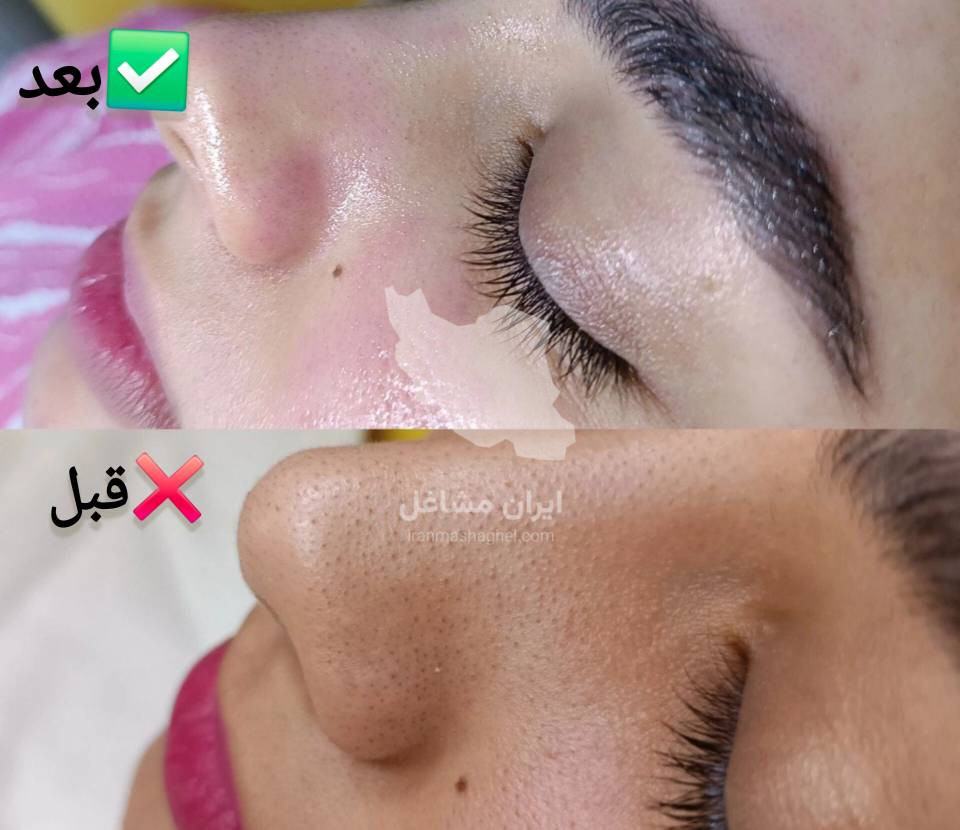 خدمات فیشیال و جوانسازی پوست به مدیریت خانم سحر پیکر در بهبهان