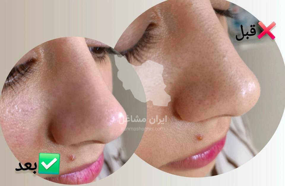 خدمات فیشیال و جوانسازی پوست به مدیریت خانم سحر پیکر در بهبهان