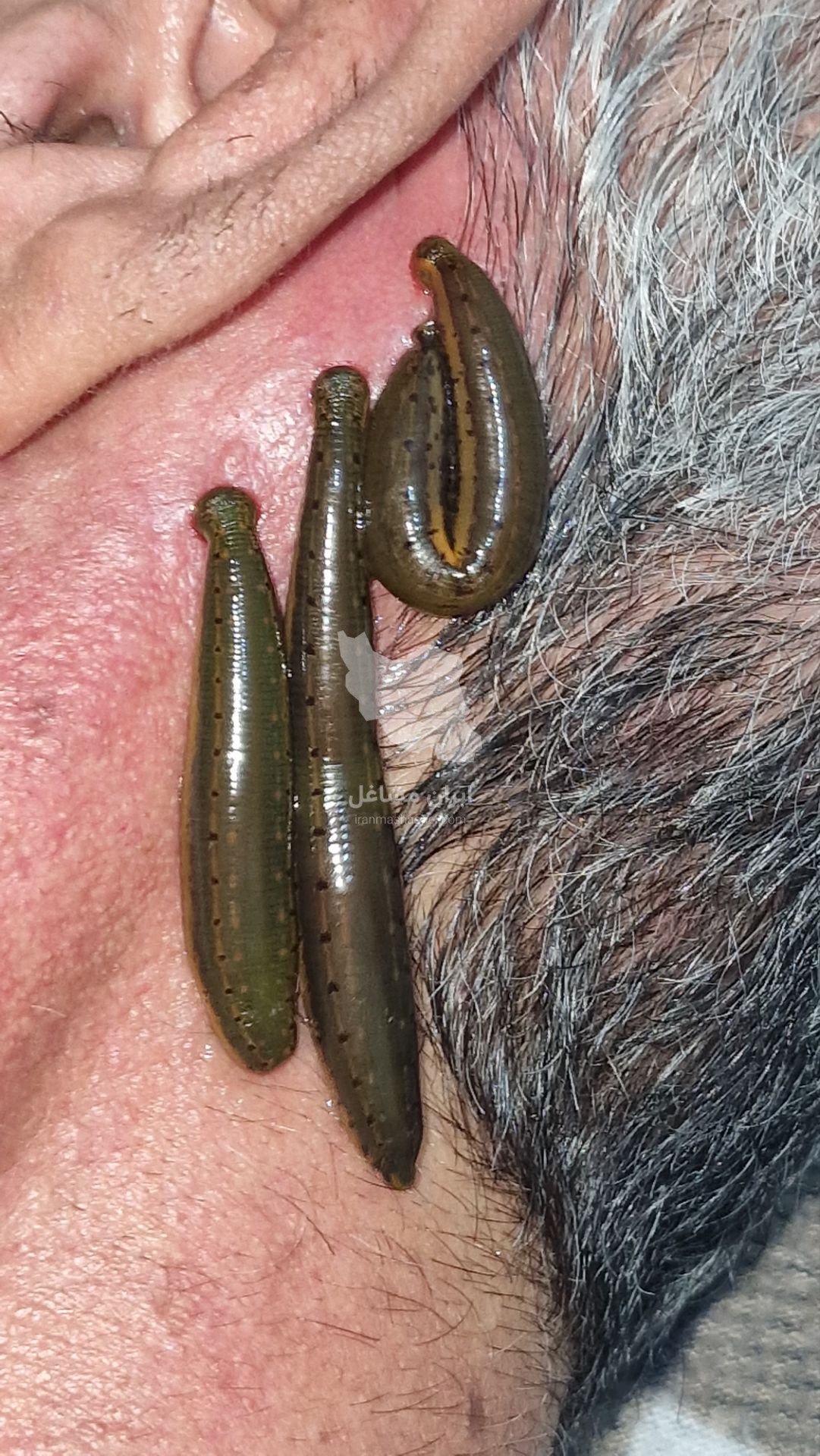 خدمات طب سنتی و ماساژ حرفه ای سلامت خانه صداقت در رباط کریم