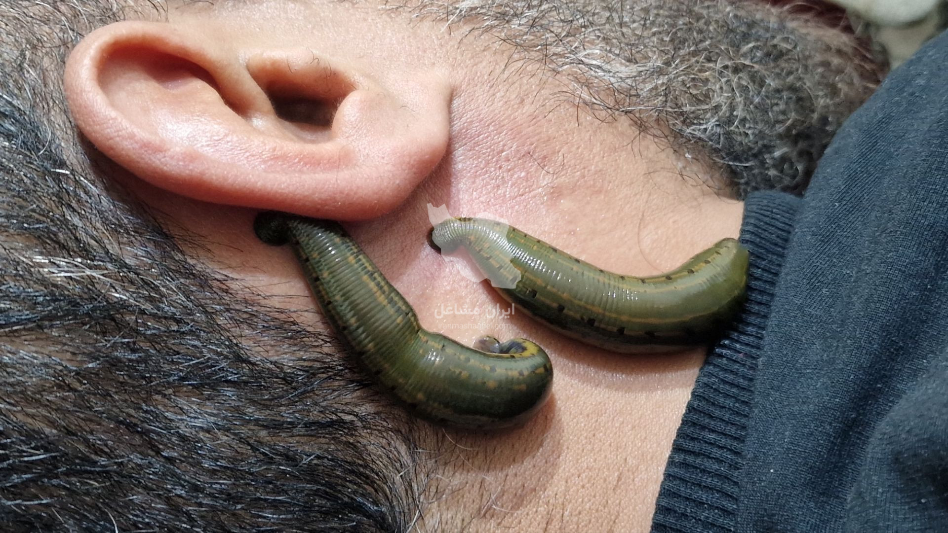 خدمات طب سنتی و ماساژ حرفه ای سلامت خانه صداقت در رباط کریم