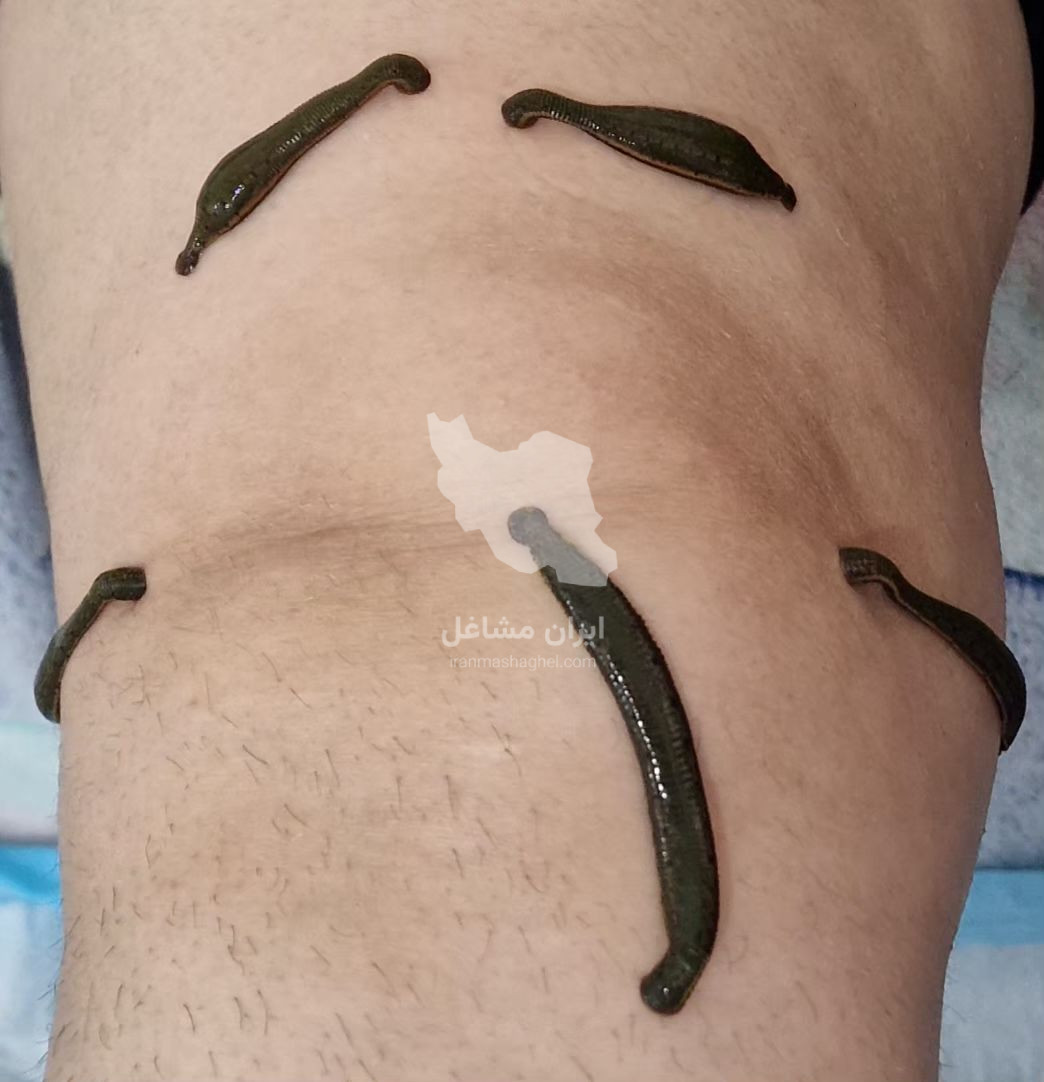 خدمات طب سنتی و ماساژ حرفه ای سلامت خانه صداقت در رباط کریم