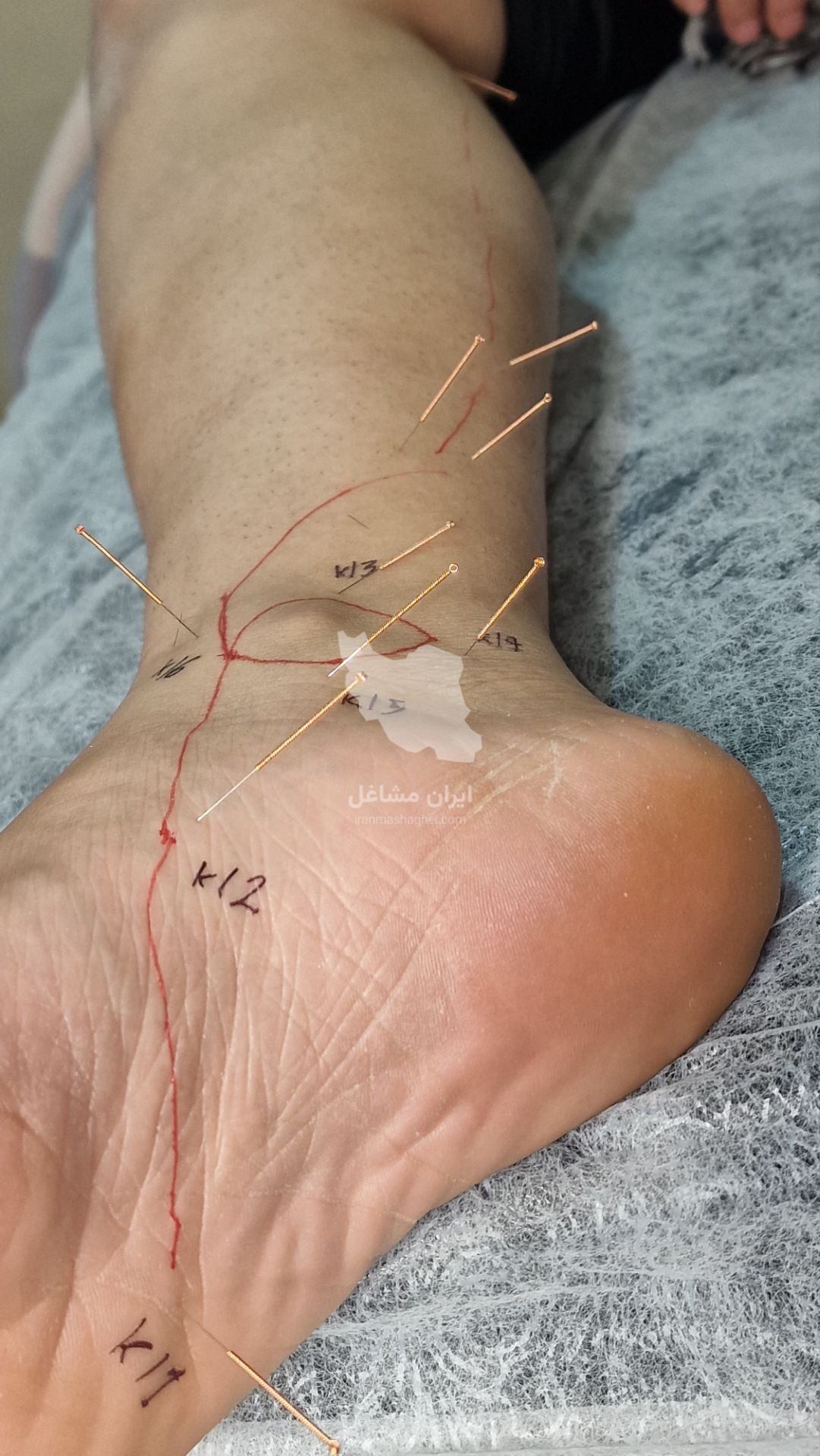 خدمات طب سنتی و ماساژ حرفه ای سلامت خانه صداقت در رباط کریم