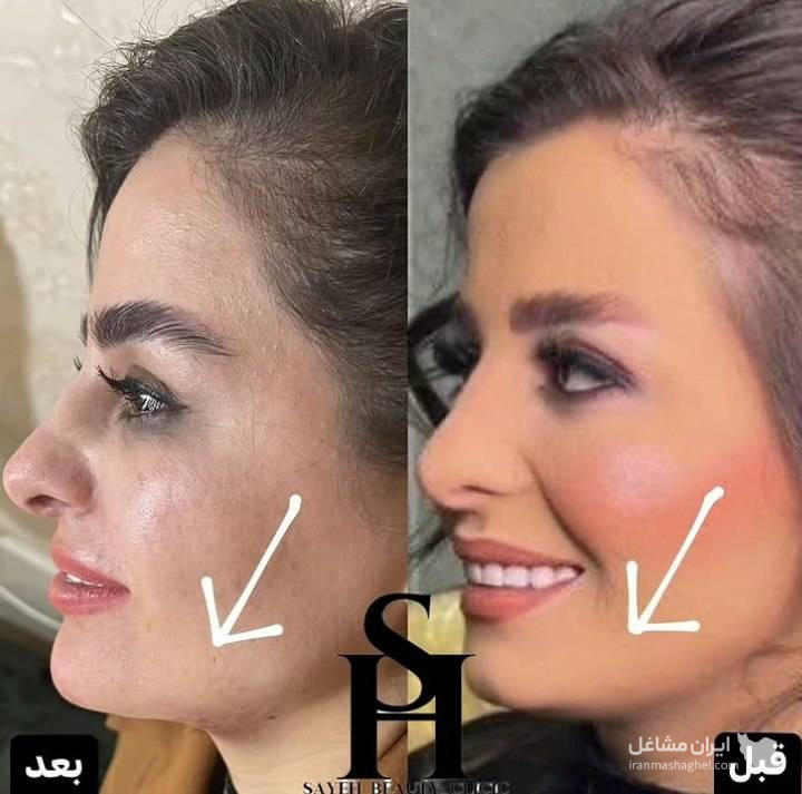 مرکز کاهش وزن و لاغری سایه در رشت
