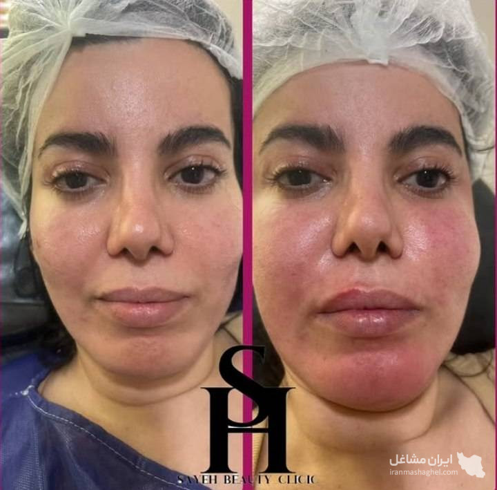 مرکز کاهش وزن و لاغری سایه در رشت