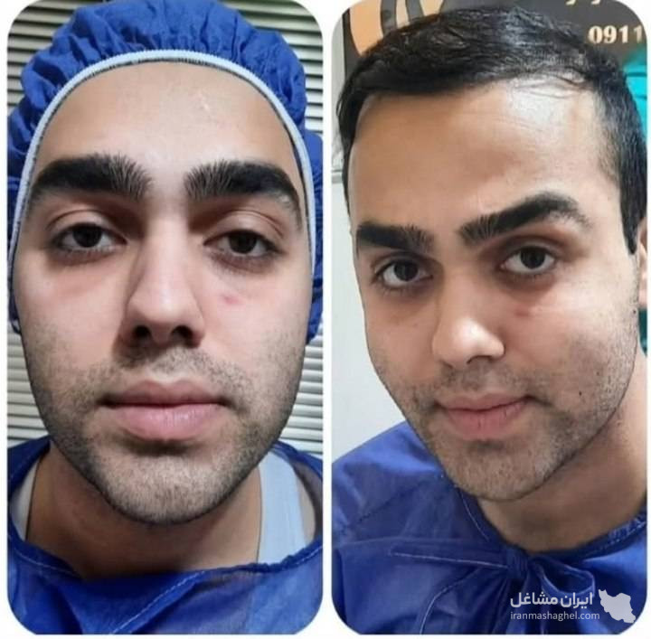 مرکز کاهش وزن و لاغری سایه در رشت