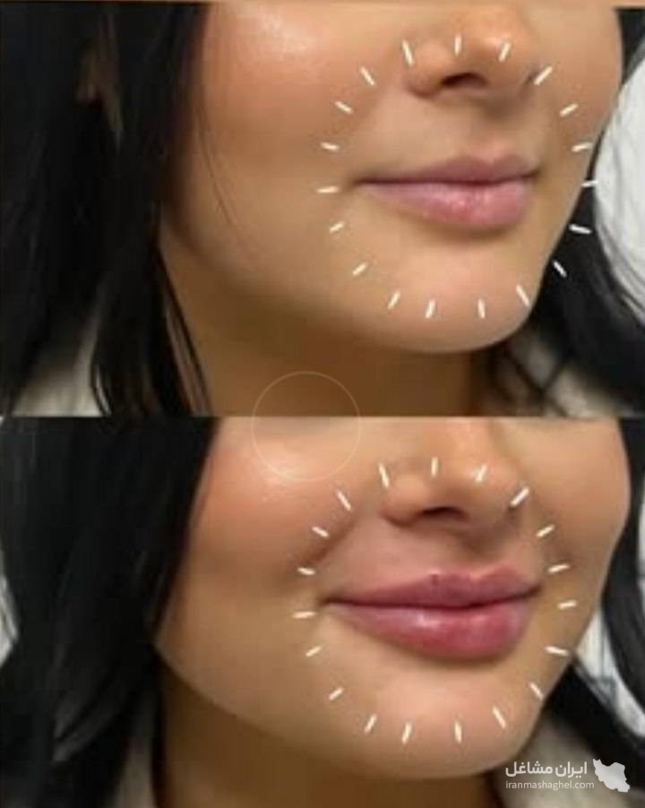 مرکز کاهش وزن و لاغری سایه در رشت