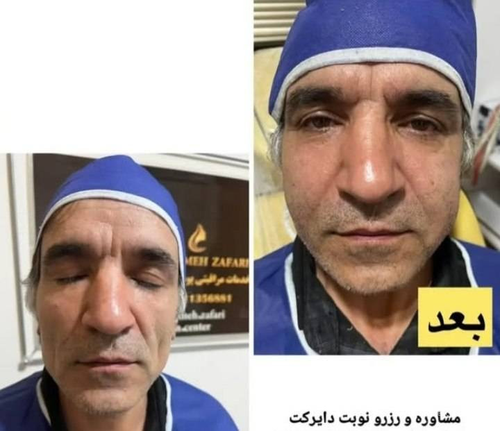 مرکز کاهش وزن و لاغری سایه در رشت