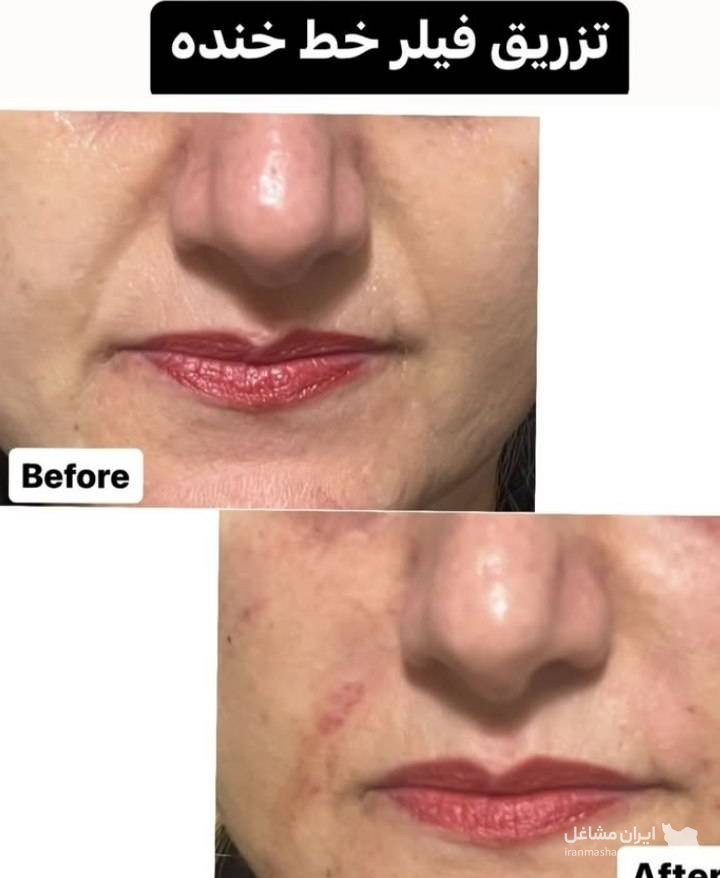 مرکز کاهش وزن و لاغری سایه در رشت