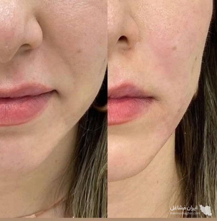 مرکز کاهش وزن و لاغری سایه در رشت