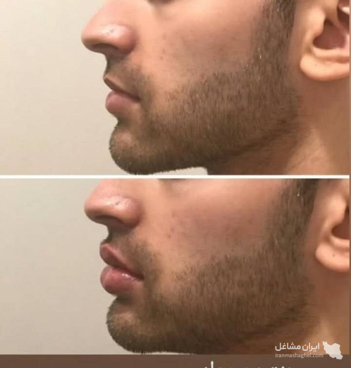 مرکز کاهش وزن و لاغری سایه در رشت