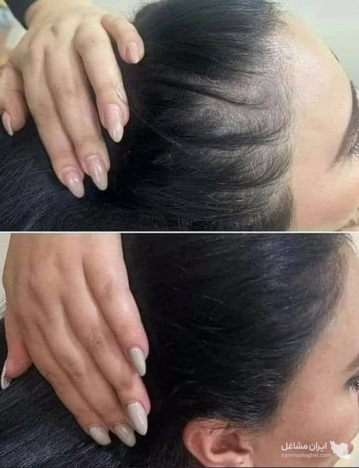 مرکز کاهش وزن و لاغری سایه در رشت