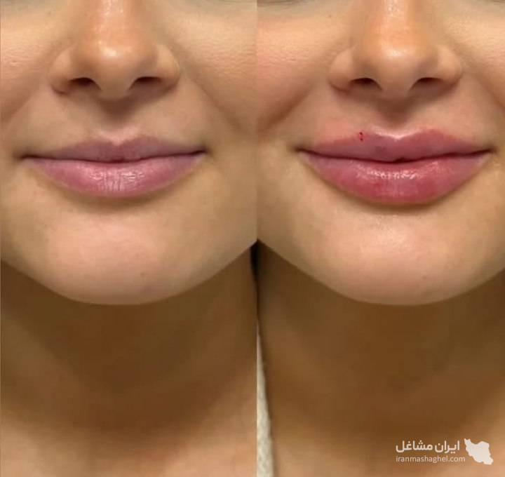 مرکز کاهش وزن و لاغری سایه در رشت