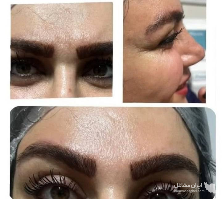 مرکز کاهش وزن و لاغری سایه در رشت