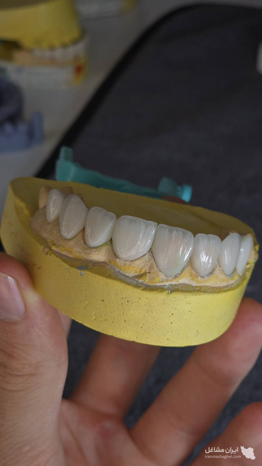 لابراتوار دیجیتال پروتزهای دندانی و پروتزهای تمام فک  تاژانی در زنجان