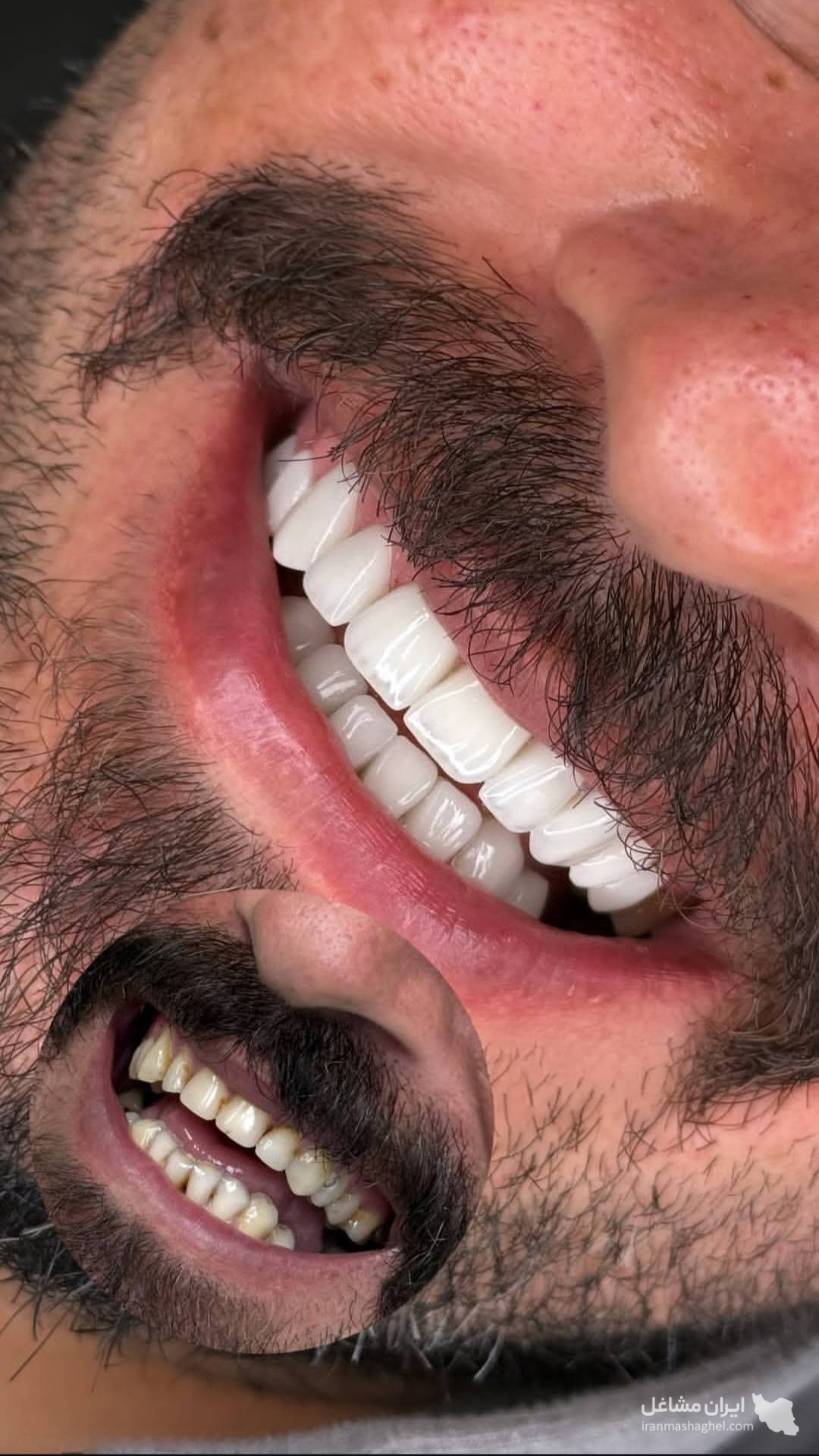 طراحی و ساخت پروتزهای دندانی و ایمپلنت دیجیتال تاژانی در اهواز