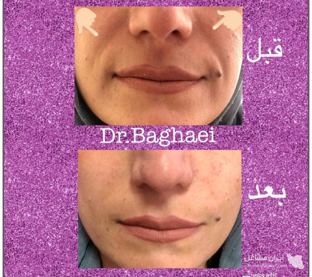 کلینیک تخصصی بوتاکس و فیلر دکتر الهه بقایی در کرمان
