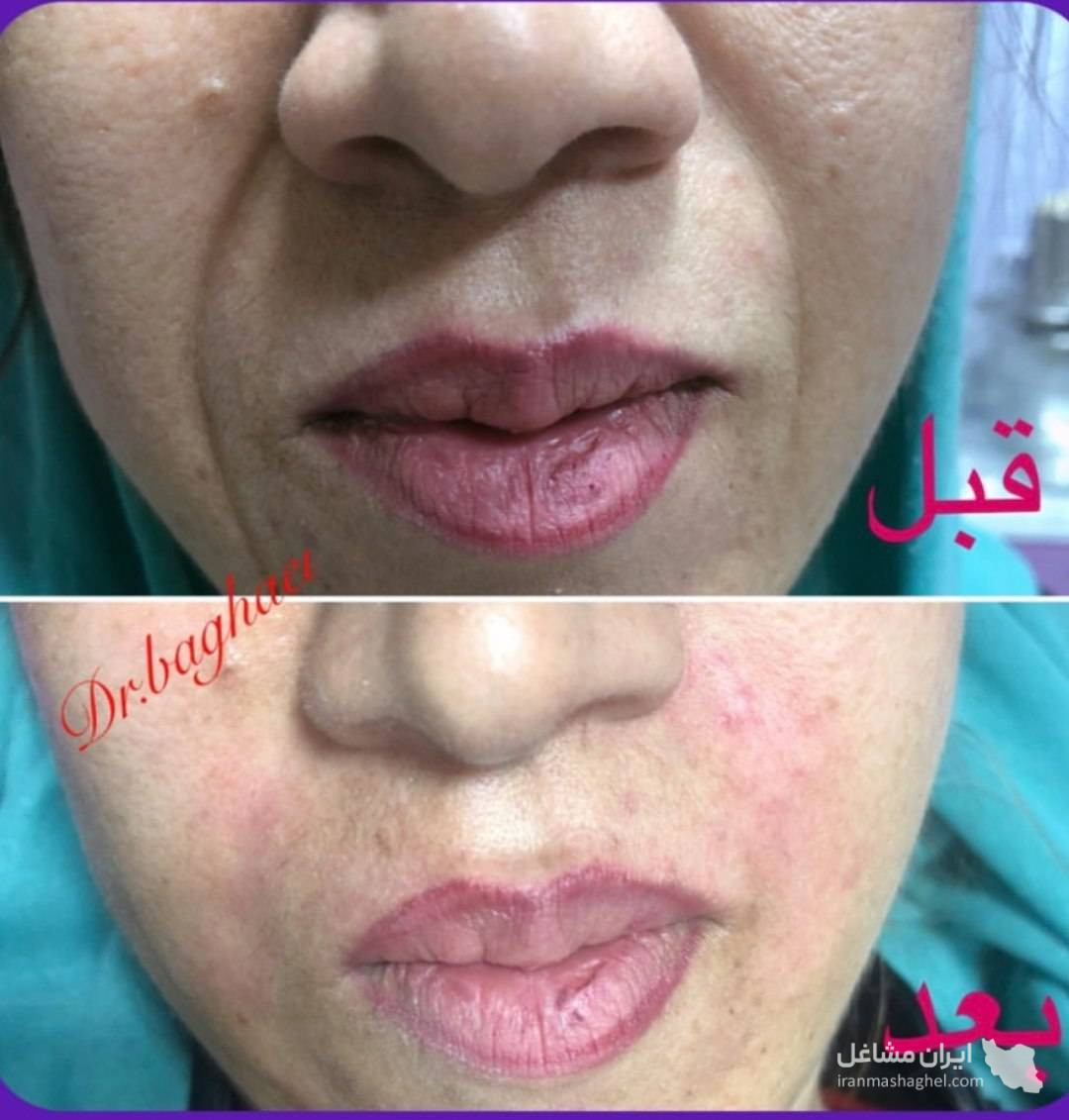 کلینیک تخصصی بوتاکس و فیلر دکتر الهه بقایی در کرمان