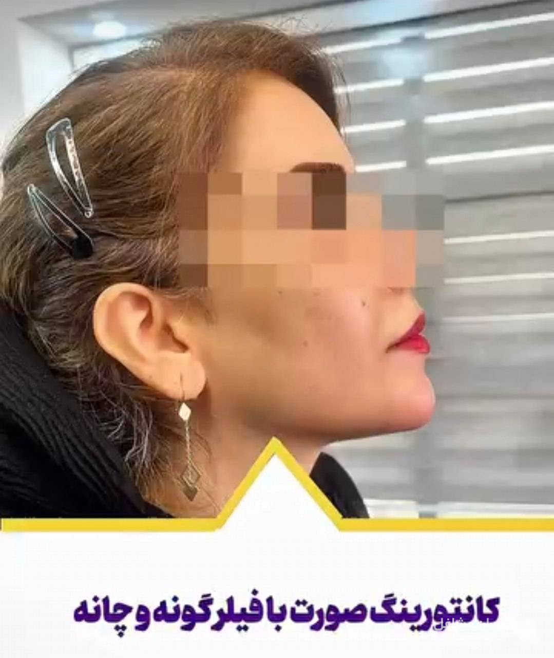 کلینیک تخصصی بوتاکس و فیلر دکتر الهه بقایی در کرمان