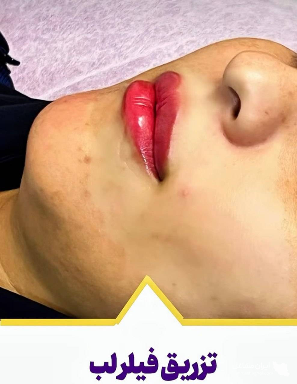 کلینیک تخصصی بوتاکس و فیلر دکتر الهه بقایی در کرمان