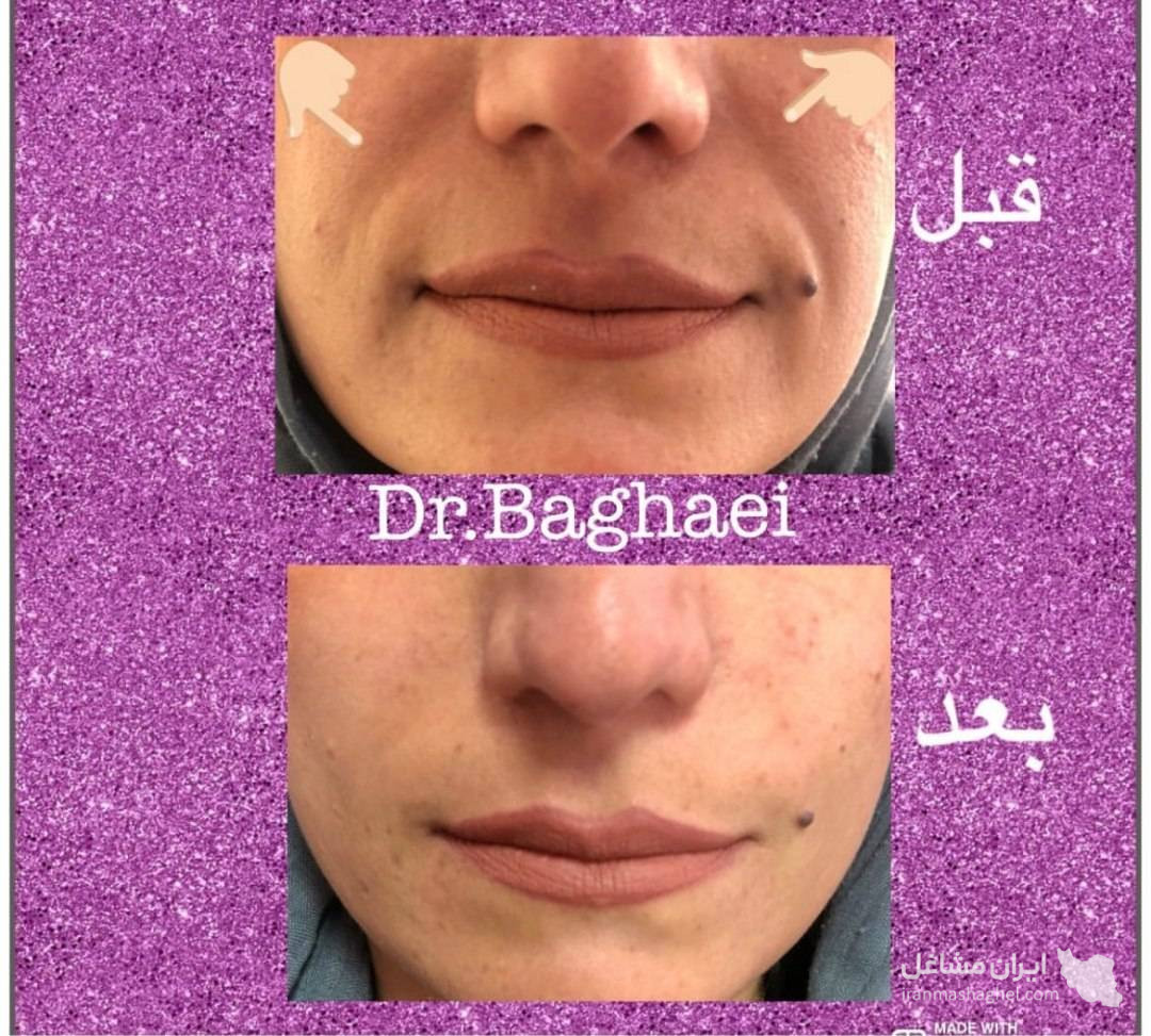 کلینیک تخصصی بوتاکس و فیلر دکتر الهه بقایی در کرمان