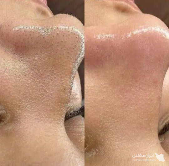 خدمات آرایش دائم و فیشیال نجاح جرفی در اهواز