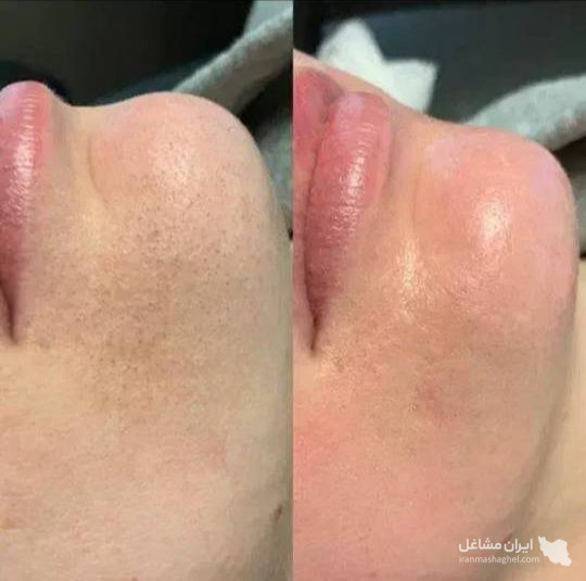 خدمات آرایش دائم و فیشیال نجاح جرفی در اهواز