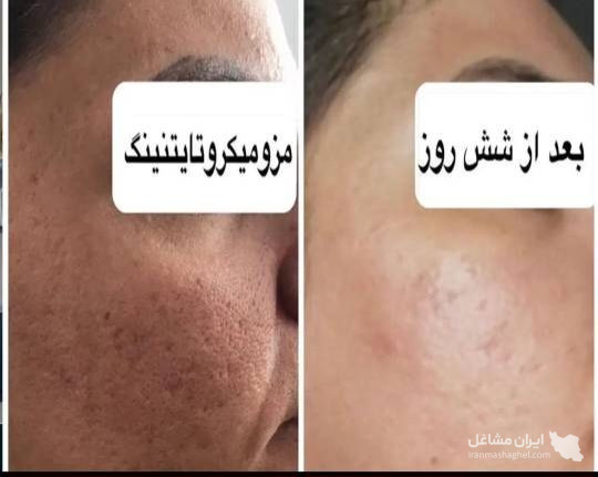خدمات آرایش دائم و فیشیال نجاح جرفی در اهواز