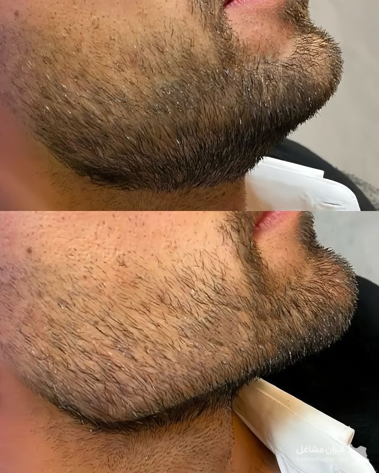 کلینیک تزریق ژل ستی در گرگان