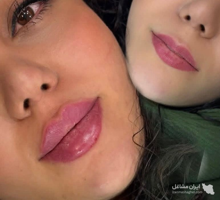 کلینیک تزریق ژل ستی در گرگان