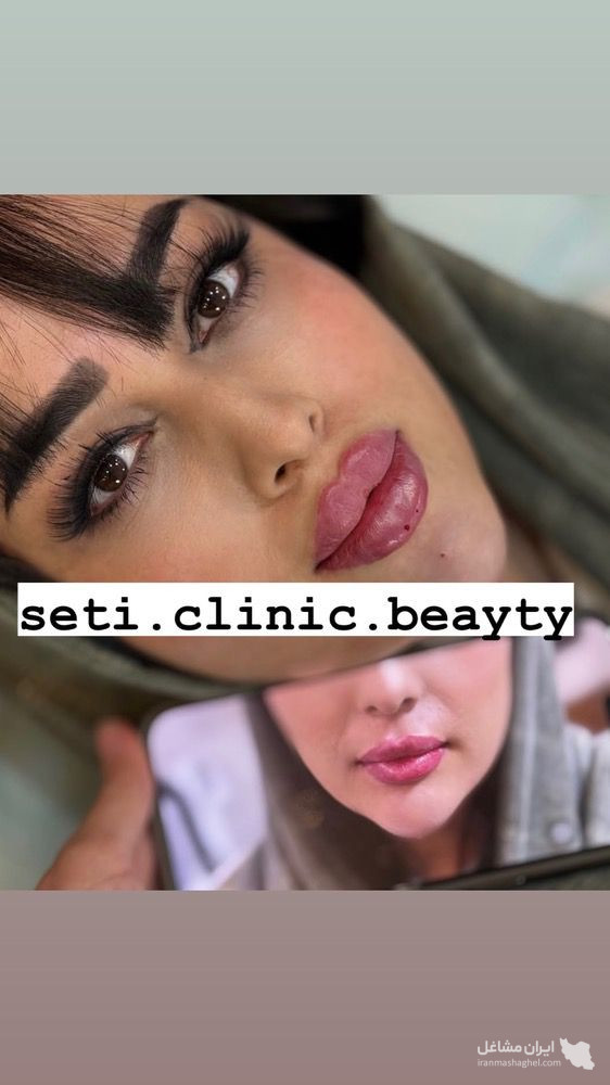 کلینیک تزریق ژل ستی در گرگان