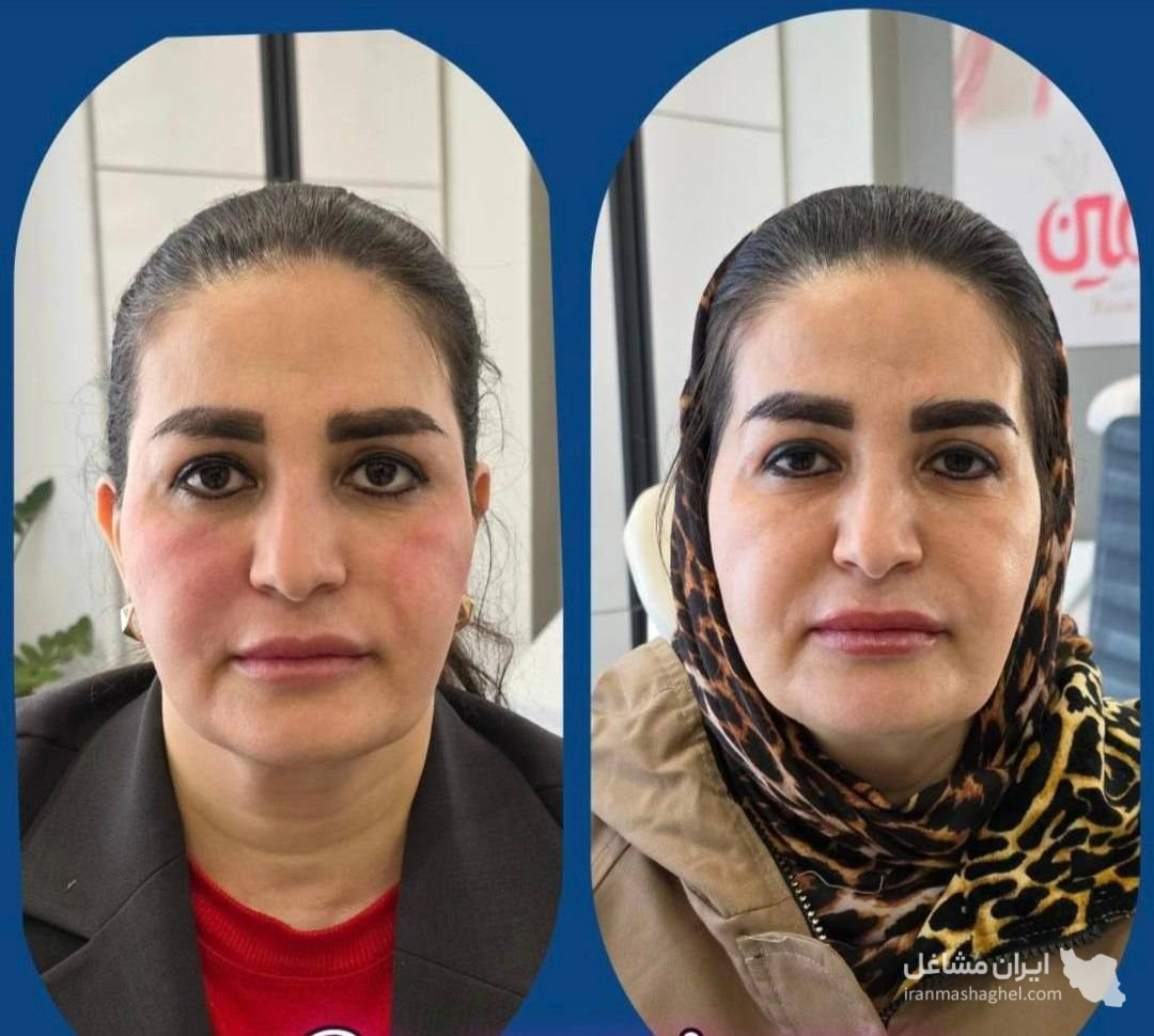 کلینیک زیبایی پوست و مو و لیزر هامین در شیراز