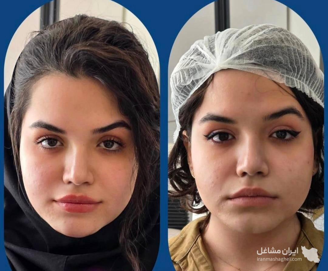 کلینیک زیبایی پوست و مو و لیزر هامین در شیراز