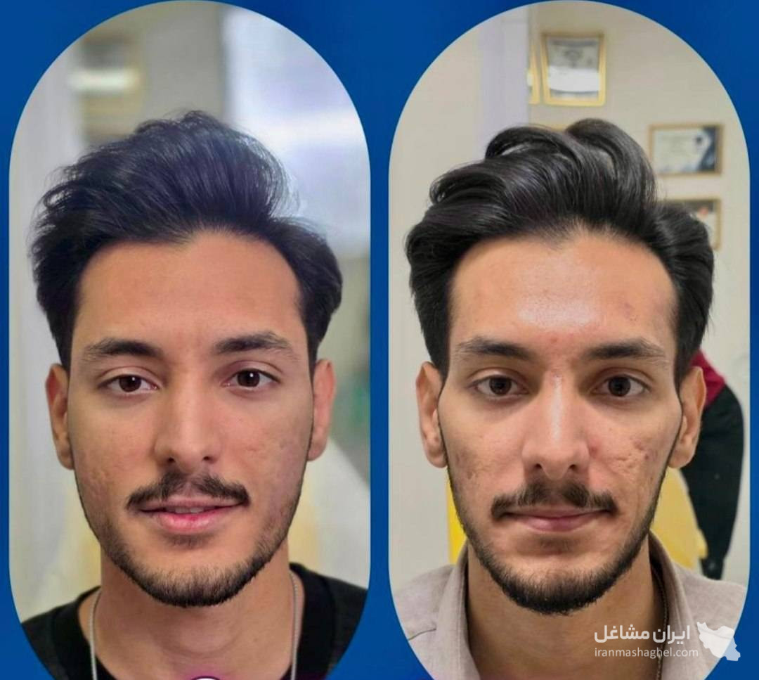 کلینیک زیبایی پوست و مو و لیزر هامین در شیراز