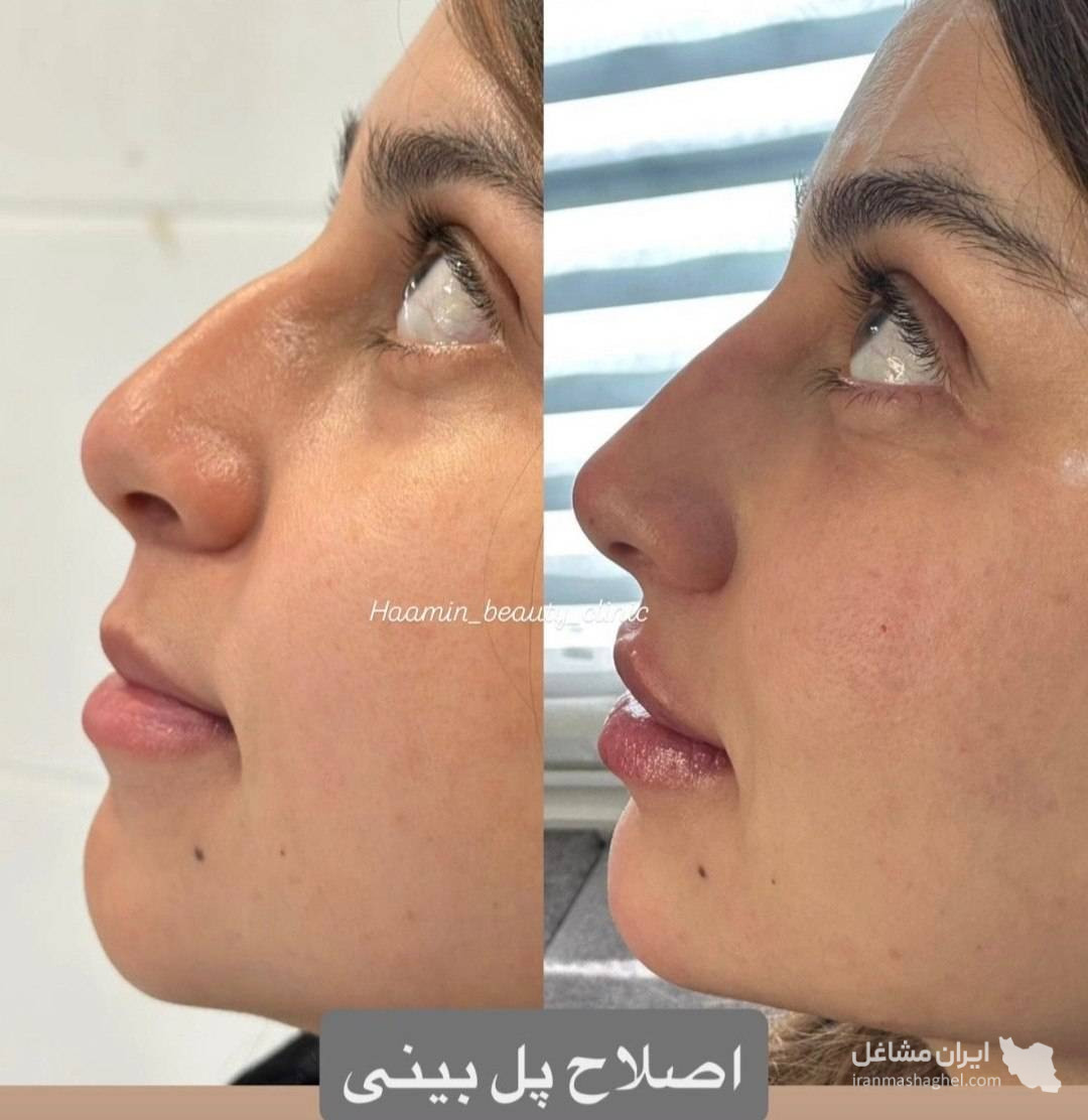 کلینیک زیبایی پوست و مو و لیزر هامین در شیراز