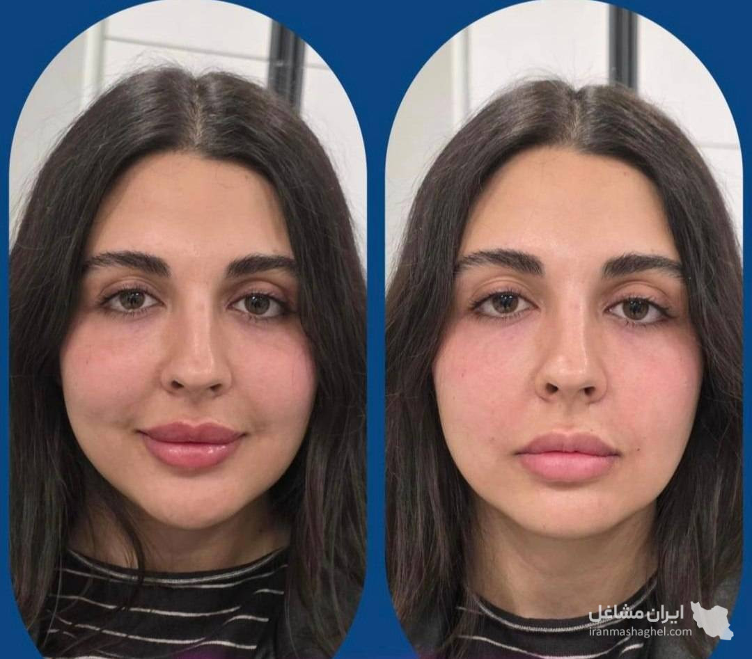 کلینیک زیبایی پوست و مو و لیزر هامین در شیراز